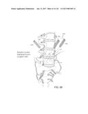 SYSTEMS, DEVICE, AND METHODS FOR JOINT FUSION diagram and image