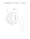 IMPLANTABLE ENCAPSULATED PROSTHETIC JOINT MODULE diagram and image