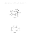 ARTIFICIAL KNEE JOINT diagram and image