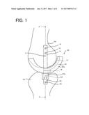 INTERNAL JOINT CAVITY EXPANDER diagram and image