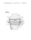 INTERNAL JOINT CAVITY EXPANDER diagram and image