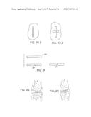 Patient Selectable Knee Arthroplasty Devices diagram and image