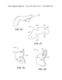 Patient Selectable Knee Arthroplasty Devices diagram and image