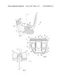 ARTIFICIAL KNEE JOINT diagram and image