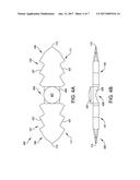 HAMMER TOE IMPLANT diagram and image