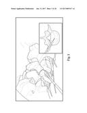 SYSTEM AND METHOD FOR PERFORMING PERCUTANEOUS SPINAL INTERBODY FUSION diagram and image