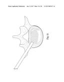 SYSTEM AND METHOD FOR PERFORMING PERCUTANEOUS SPINAL INTERBODY FUSION diagram and image