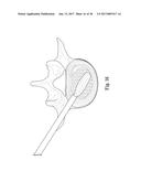 SYSTEM AND METHOD FOR PERFORMING PERCUTANEOUS SPINAL INTERBODY FUSION diagram and image