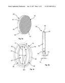 FACET JOINT PROSTHESIS diagram and image