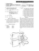 Linked Bilateral Spinal Facet Implants and Methods of Use diagram and image