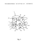 Linked Bilateral Spinal Facet Implants and Methods of Use diagram and image