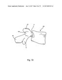 Linked Bilateral Spinal Facet Implants and Methods of Use diagram and image