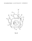 Linked Bilateral Spinal Facet Implants and Methods of Use diagram and image