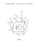 Linked Bilateral Spinal Facet Implants and Methods of Use diagram and image