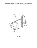 Linked Bilateral Spinal Facet Implants and Methods of Use diagram and image