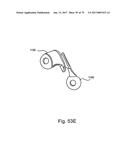 Linked Bilateral Spinal Facet Implants and Methods of Use diagram and image