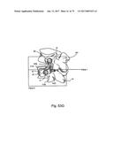 Linked Bilateral Spinal Facet Implants and Methods of Use diagram and image