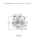 Linked Bilateral Spinal Facet Implants and Methods of Use diagram and image