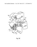 Linked Bilateral Spinal Facet Implants and Methods of Use diagram and image