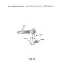 Linked Bilateral Spinal Facet Implants and Methods of Use diagram and image