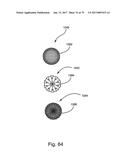 Linked Bilateral Spinal Facet Implants and Methods of Use diagram and image