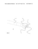 SYSTEMS AND METHODS FOR SPINAL FUSION diagram and image