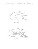 EXPANDABLE INTERBODY SPACER diagram and image