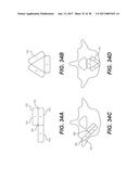 EXPANDABLE INTERBODY SPACER diagram and image