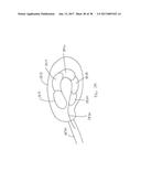 EXPANDABLE INTERBODY SPACER diagram and image