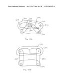 EXPANDABLE INTERBODY SPACER diagram and image