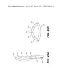 EXPANDABLE INTERBODY SPACER diagram and image