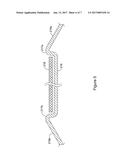 METHOD FOR IMPROVING STENT RETENTION AND DEPLOYMENT CHARACTERISTICS diagram and image