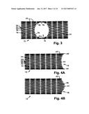 STENT SYSTEM, DEPLOYMENT APPARATUS AND METHOD FOR BIFURCATED LESION diagram and image