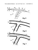 STENT SYSTEM, DEPLOYMENT APPARATUS AND METHOD FOR BIFURCATED LESION diagram and image