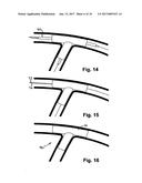 STENT SYSTEM, DEPLOYMENT APPARATUS AND METHOD FOR BIFURCATED LESION diagram and image