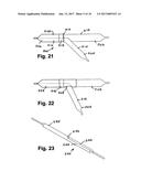 STENT SYSTEM, DEPLOYMENT APPARATUS AND METHOD FOR BIFURCATED LESION diagram and image