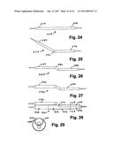 STENT SYSTEM, DEPLOYMENT APPARATUS AND METHOD FOR BIFURCATED LESION diagram and image