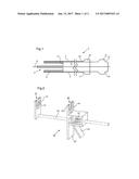 STENT PLACEMENT DEVICE diagram and image