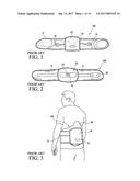 SPINAL ORTHOSIS, KIT AND METHOD FOR USING THE SAME diagram and image