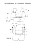 SPINAL ORTHOSIS, KIT AND METHOD FOR USING THE SAME diagram and image