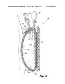 UTERINE COMPRESSION DEVICES AND METHODS diagram and image