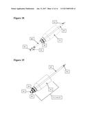 HYDRO-BLOCK AIR VENT COMBINATION CATHETER SYSTEM AND METHOD OF USE diagram and image