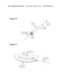 HYDRO-BLOCK AIR VENT COMBINATION CATHETER SYSTEM AND METHOD OF USE diagram and image