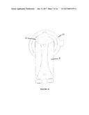 Ostomy Appliance Collar diagram and image