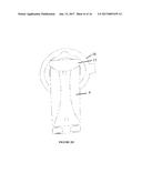 Ostomy Appliance Collar diagram and image