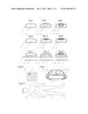 Cooling Mat Comprising Expandable Elements for Cooling a Body or Body Part     for Medical or Performance-Enhancing Purposes (COOL APP) diagram and image