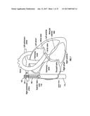 SYSTEM AND METHOD FOR INDUCING HYPOTHERMIA WITH CONTROL AND DETERMINATION     OF CATHETER PRESSURE diagram and image