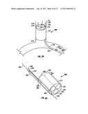 SYSTEM AND METHOD FOR INDUCING HYPOTHERMIA WITH CONTROL AND DETERMINATION     OF CATHETER PRESSURE diagram and image