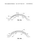 OPHTHALMOLOGICAL APPARATUS FOR THE BREAKDOWN OF EYE TISSUE diagram and image