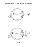 AUGMENTED AND VIRTUAL REALITY DISPLAY SYSTEMS AND METHODS FOR DELIVERY OF     MEDICATION TO EYES diagram and image